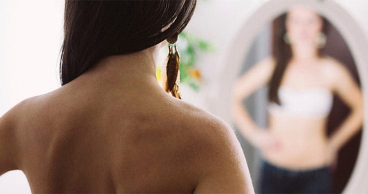 Myths about eating disorders