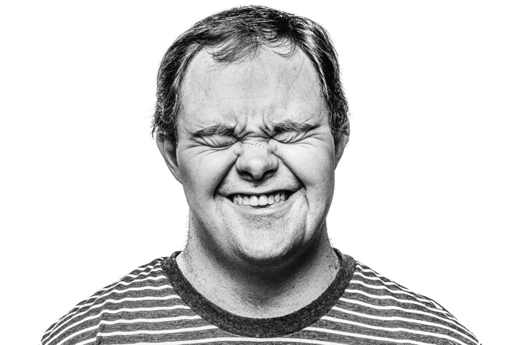 Man with Down syndrome laughing