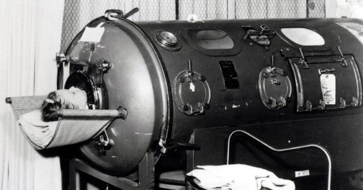 Young girl in an iron lung