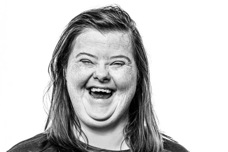 Woman with Down syndrome laughing