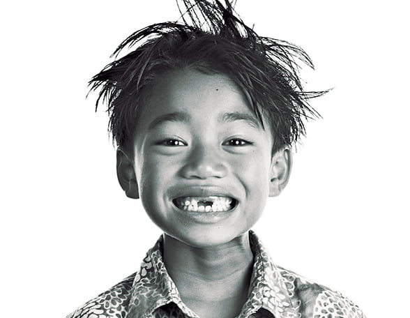 Child with a disability with a big smile and spiky hair